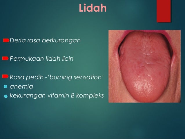 Kesihatan pergigian warga emas