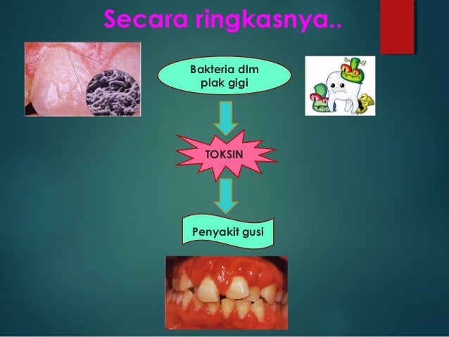 Kesihatan pergigian warga emas