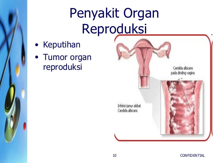 Kesehatan Alat Reproduksi Kim-C