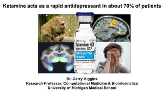 Ketamine acts as a rapid antidepressant in about 70% of patients
Dr. Gerry Higgins
Research Professor, Computational Medicine & Bioinformatics
University of Michigan Medical School
 
