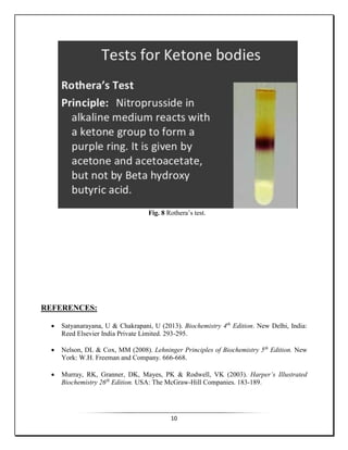 10
Fig. 8 Rothera’s test.
REFERENCES:
 Satyanarayana, U & Chakrapani, U (2013). Biochemistry 4th
Edition. New Delhi, India:
Reed Elsevier India Private Limited. 293-295.
 Nelson, DL & Cox, MM (2008). Lehninger Principles of Biochemistry 5th
Edition. New
York: W.H. Freeman and Company. 666-668.
 Murray, RK, Granner, DK, Mayes, PK & Rodwell, VK (2003). Harper’s Illustrated
Biochemistry 26th
Edition. USA: The McGraw-Hill Companies. 183-189.
 