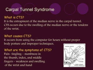 Carpal Tunnel Syndrome What is CTS? It is the entrapment of the median nerve in the carpal tunnel.  CTS occurs due to the swelling of the median nerve or the tendons of the wrist. What causes CTS? It occurs from using the computer for hours without proper  body posture and improper techniques. What are the symptoms of CTS? Pain- tingling – numbness in  the thumb, index, and middle  fingers – weakness and swelling of the wrist and hand  