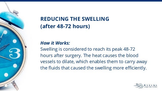 How to Reduce Swelling After Wisdom Teeth Removal