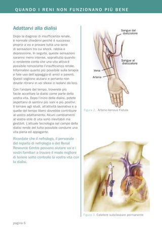 QUANDO I RENI NON FUNZIONANO PIÙ BENE



Adattarvi alla dialisi                                                         Sangue dal
                                                                                dializzatore
Dopo la diagnosi di insufficienza renale,
è normale chiedervi perché è successo
proprio a voi e provare tutta una serie
di sensazioni tra cui shock, rabbia e
depressione. In seguito, queste sensazioni
saranno meno intense, soprattutto quando
vi renderete conto che una vita attiva è                                        Sangue al
                                                                                dializzatore
possibile nonostante l’insufficienza renale.
Informatevi quanto più possibile sulla terapia              Vena
e fate uso dell’appoggio di amici e parenti.
                                                           Arteria
Questi vogliono aiutarvi e pertanto non
dovete ritirarvi in voi stessi o isolarvi da loro.
Con l’andare del tempo, troverete più
facile accettare la dialisi come parte della
vostra vita. Dopo l’inizio della dialisi, potete
aspettarvi di sentirvi più sani e più positivi.
Il tornare agli studi, all’attività lavorativa e a
quelle del tempo libero dovrebbe contribuire         Figura 2. Arterio-Venous Fistula
al vostro adattamento. Alcuni cambiamenti
al vostro stile di vita sono inevitabili ma
gestibili. L’attuale tecnologia nel campo della
dialisi rende del tutto possibile condurre una
vita piena ed appagante.

Ricordate che il nefrologo, il personale
del reparto di nefrologia o del Renal
Resource Centre possono aiutare voi e i
vostri familiari a trovare il modo migliore
di tenere sotto controllo la vostra vita con
la dialisi.




                                                     Figura 3. Catetere subclaveare permanente

pagina 6
 