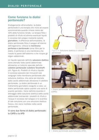 DIALISI PERITONEALE



Come funziona la dialisi
peritoneale?
Analogamente all’emodialisi, la dialisi
peritoneale è una terapia che inizia ad essere
somministrata quando rimane meno del
10% della funzione renale. La terapia filtra i
prodotti di rifiuto ed elimina eventuali liquidi
in eccesso dal sangue mediante sedute
giornaliere. A differenza dell’emodialisi, la
dialisi peritoneale filtra il sangue all’interno
dell’organismo. Utilizza la membrana
peritonea o peritoneale come filtro per la
dialisi. Il peritoneo è una membrana che           Figura 4. Soluzione dialitica e catetere
riveste le pareti dell’addome e che ricopre gli    peritoneali
organi addominali.
Un liquido speciale definito soluzione dialitica
viene drenato nella cavità addominale
attraverso un tubicino speciale definito
catetere peritoneale (catetere Tenckhoff)
(cfr. Figura 4). Prodotti di rifiuto e liquido
in eccesso passano dai minuscoli vasi
sanguigni nella membrana peritoneale alla
soluzione dialitica, che viene poi drenata
dalla cavità addominale attraverso il catetere
peritoneale. La dialisi peritoneale è un
trattamento giornaliero eseguito a casa. La
dialisi peritoneale opera usando una serie di      > Dialisi peritoneale ambulatoriale continua
scambi periodici. Viene definito scambio il        (CAPD)
drenaggio della soluzione dialitica dalla cavità
addominale (estraendo i prodotti di rifiuto e
l’acqua in eccesso dal sangue) e lo scambio
di tale soluzione con una soluzione dialitica
fresca, che viene instillata nella cavità
peritoneale.

Vi sono due forme di dialisi peritoneale:
la CAPD e la APD




                                                   > Dialisi peritoneale automatizzata (APD)

pagina 12
 