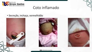 Coto inflamado
• Secreção, inchaço, vermelhidão
 