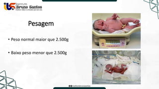 Pesagem
• Peso normal maior que 2.500g
• Baixo peso menor que 2.500g
 