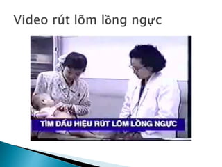 Khó thở da sua