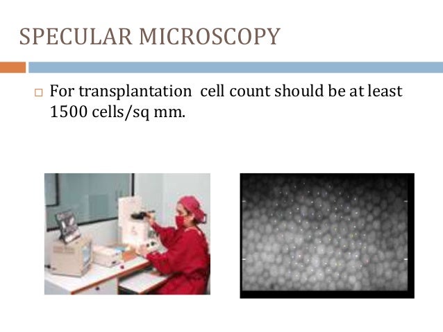 Essay eye donation keratoplasty 04 picture