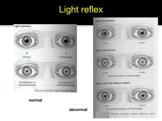 Normal Reflex Number Kham dong tu cao phi phong (2017) | PDF