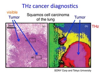 THz 
cancer 
diagnos9cs 
Squamos cell carcinoma ! 
Tumor! Tumor! 
of the lung ! 
SONY Corp and Tokyo University! 
visible! 
THz! 
 
