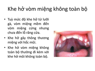 Lưỡi gà chẻ đôi: Hãy ngắm nhìn bức ảnh về lưỡi gà chẻ đôi và khám phá vẻ đẹp độc đáo của nó. Lưỡi gà chẻ đôi là dấu hiệu của sự kỳ diệu trong tự nhiên và thật đáng yêu đến không ngờ!