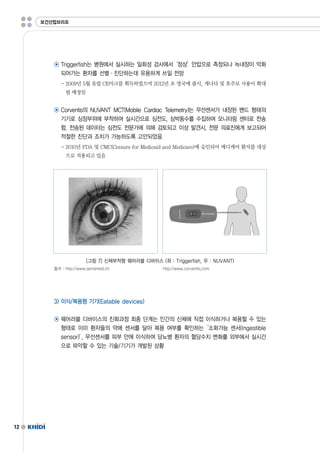 12 
보건산업브리프 
◉ Triggerfish는 병원에서 실시하는 일회성 검사에서‘정상’안압으로 측정되나 녹내장이 악화 
되어가는 환자를 선별·진단하는데 유용하게 쓰일 전망 
-2009년 5월 유럽 CE마크를 획득하였으며 2012년 초 영국에 출시,캐나다 및 호주로 사용이 확대 
될 예정임 
◉ Corventis의 NUVANTMCT(MobileCardiacTelemetry)는 무선센서가 내장된 밴드 형태의 
기기로 심장부위에 부착하여 실시간으로 심전도,심박동수를 수집하여 모니터링 센터로 전송 
함.전송된 데이터는 심전도 전문가에 의해 검토되고 이상 발견시,전문 의료진에게 보고되어 
적절한 진단과 조치가 가능하도록 고안되었음 
-2010년 FDA및 CMC(CentersforMedicaidandMedicare)에 승인되어 메디케어 환자를 대상 
으로 적용되고 있음 
[그림 7]신체부착형 웨어러블 디바이스 (좌 :Triggerfish,우 :NUVANT) 
출처 :http://www.sensimed.ch http://www.corventis.com 
3)이식/복용형 기기(Eatabledevices) 
◉ 웨어러블 디바이스의 진화과정 최종 단계는 인간의 신체에 직접 이식하거나 복용할 수 있는 
형태로 이미 환자들의 약에 센서를 달아 복용 여부를 확인하는‘소화가능 센서(Ingestible 
sensor)’,무선센서를 피부 안에 이식하여 당뇨병 환자의 혈당수치 변화를 외부에서 실시간 
으로 파악할 수 있는 기술/기기가 개발된 상황 
 