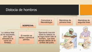 Distocia de hombros
SOSPECHA:
La cabeza fetal
se ha expulsado,
pero sigue
adosada a la
vulva con
firmeza.
El mentón se
retrae y oprime el
perineo.
Ejerciendo tracción
sobre la cabeza no
se logra hacer salir el
hombro, que está
atorado detrás de la
sínfisis del pubis.
Comunicar a
Neonatología
Maniobras de
primera línea
Maniobras de
segunda línea
 