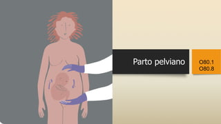 Parto pelviano O80.1
O80.8
 