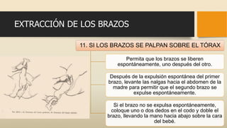 EXTRACCIÓN DE LOS BRAZOS
11. SI LOS BRAZOS SE PALPAN SOBRE EL TÓRAX
Permita que los brazos se liberen
espontáneamente, uno después del otro.
Después de la expulsión espontánea del primer
brazo, levante las nalgas hacia el abdomen de la
madre para permitir que el segundo brazo se
expulse espontáneamente.
Si el brazo no se expulsa espontáneamente,
coloque uno o dos dedos en el codo y doble el
brazo, llevando la mano hacia abajo sobre la cara
del bebé.
 