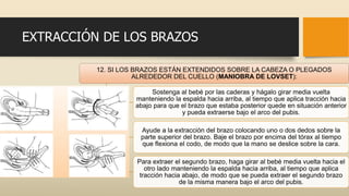 EXTRACCIÓN DE LOS BRAZOS
12. SI LOS BRAZOS ESTÁN EXTENDIDOS SOBRE LA CABEZA O PLEGADOS
ALREDEDOR DEL CUELLO (MANIOBRA DE LOVSET):
Sostenga al bebé por las caderas y hágalo girar media vuelta
manteniendo la espalda hacia arriba, al tiempo que aplica tracción hacia
abajo para que el brazo que estaba posterior quede en situación anterior
y pueda extraerse bajo el arco del pubis.
Ayude a la extracción del brazo colocando uno o dos dedos sobre la
parte superior del brazo. Baje el brazo por encima del tórax al tiempo
que flexiona el codo, de modo que la mano se deslice sobre la cara.
Para extraer el segundo brazo, haga girar al bebé media vuelta hacia el
otro lado manteniendo la espalda hacia arriba, al tiempo que aplica
tracción hacia abajo, de modo que se pueda extraer el segundo brazo
de la misma manera bajo el arco del pubis.
 