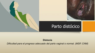 Parto distócico
Distocia
Dificultad para el progreso adecuado del parto vaginal o normal. (MSP, CNM)
 