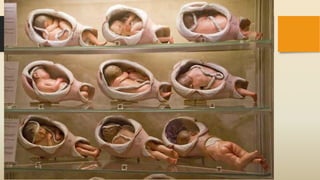 Distocias y pelviana