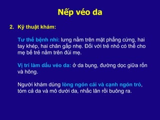 Nếp véo da
2. Kỹ thuật khám:
Tư thế bệnh nhi: lưng nằm trên mặt phẳng cứng, hai
tay khép, hai chân gấp nhẹ. Đối với trẻ nhỏ có thể cho
mẹ bế trẻ nằm trên đùi mẹ.
Vị trí làm dấu véo da: ở da bụng, đường dọc giữa rốn
và hông.
Người khám dùng lòng ngón cái và cạnh ngón trỏ,
tóm cả da và mô dưới da, nhấc lân rồi buông ra.
 
