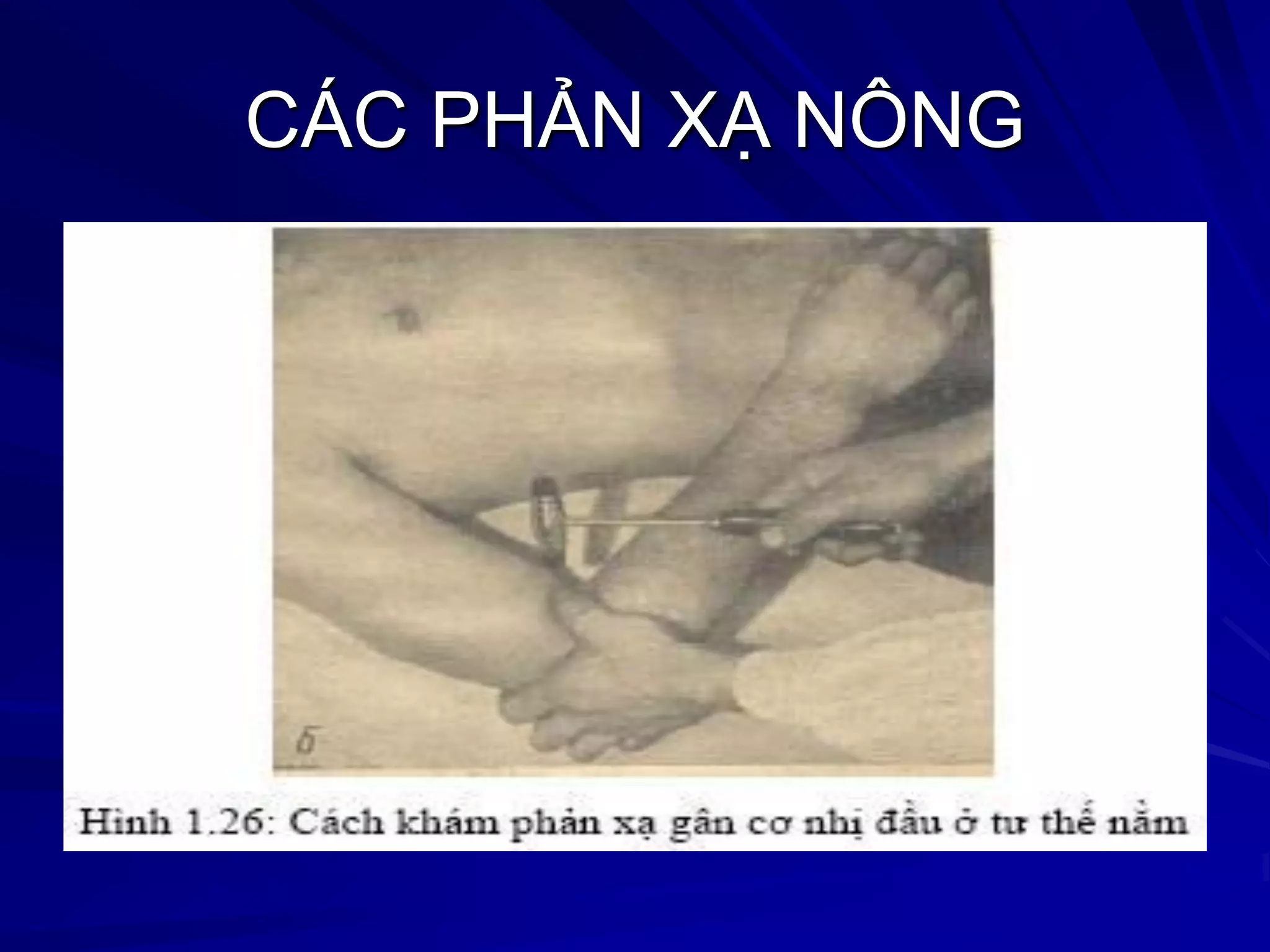 CÁC PHẢN XẠ NÔNG
 