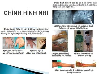 CHỈNHHÌNHNHI