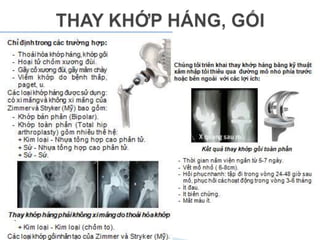 THAYKHỚPHÁNG, GỐI