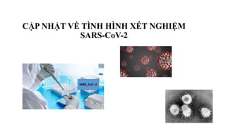 CẬP NHẬT VỀ TÌNH HÌNH XÉT NGHIỆM
SARS-CoV-2
SARS_CoV -2
 
