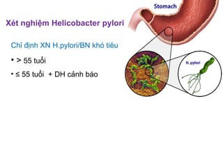 Xét nghiệm Helicobacter pylori
Chỉ định XN H.pylori/BN khó tiêu
• > 55 tuổi
• ≤ 55 tuổi + DH cảnh báo
 
