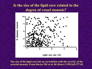 Is the size of the lipid core related to the
degree of vessel stenosis?
The size of the lipid core has no correlation with the severity of the
arterial stenosis. From Davies MJ et al. Br Heart J 1993;69:377-81
 