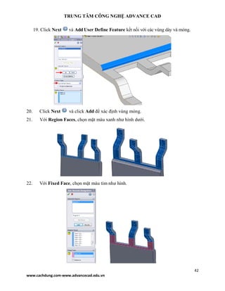 TRUNG TÂM CÔNG NGHỆ ADVANCE CAD
42
www.cachdung.com-www.advancecad.edu.vn
19. Click Next và Add User Define Feature kết nối với các vùng dày và mỏng.
20. Click Next và click Add để xác định vùng mỏng.
21. Với Region Faces, chọn mặt màu xanh như hình dưới.
22. Với Fixed Face, chọn mặt màu tím như hình.
 