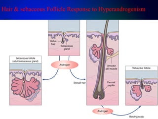 Hair & sebaceous Follicle Response to Hyperandrogenism
 