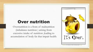 Malnutrition by Khushboo .pptx