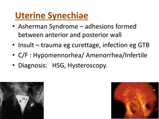 Uterine Synechiae
• Asherman Syndrome – adhesions formed
between anterior and posterior wall
• Insult – trauma eg curettage, infection eg GTB
• C/F : Hypomennorhea/ Amenorrhea/Infertile
• Diagnosis: HSG, Hysteroscopy.
 