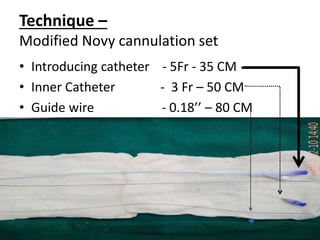 Technique –
Modified Novy cannulation set
• Introducing catheter - 5Fr - 35 CM
• Inner Catheter - 3 Fr – 50 CM
• Guide wire - 0.18’’ – 80 CM
 