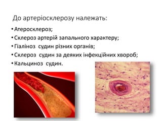 До артеріосклерозу належать:
•Атеросклероз;
•Склероз артерій запального характеру;
•Гіаліноз судин різних органів;
•Склероз судин за деяких інфекційних хвороб;
•Кальциноз судин.
 