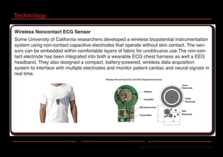 Technology
Source: http://www.isn.ucsd.edu/pubs/wh2010.pdf
Wireless Noncontact ECG Sensor
Some University of California researchers developed a wireless biopotential instrumentation
system using non-contact capacitive electrodes that operate without skin contact. The sen-
sors can be embedded within comfortable layers of fabric for unobtrusive use.The non-con-
tact electrode has been integrated into both a wearable ECG chest harness as well a EEG
headband. They also designed a compact, battery-powered, wireless data acquisition
system to interface with multiple electrodes and monitor patient cardiac and neural signals in
real time.
 