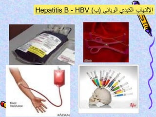 (‫)ب‬ ‫الوبائي‬ ‫الكبدي‬ ‫اللتهاب‬Hepatitis B - HBV
 