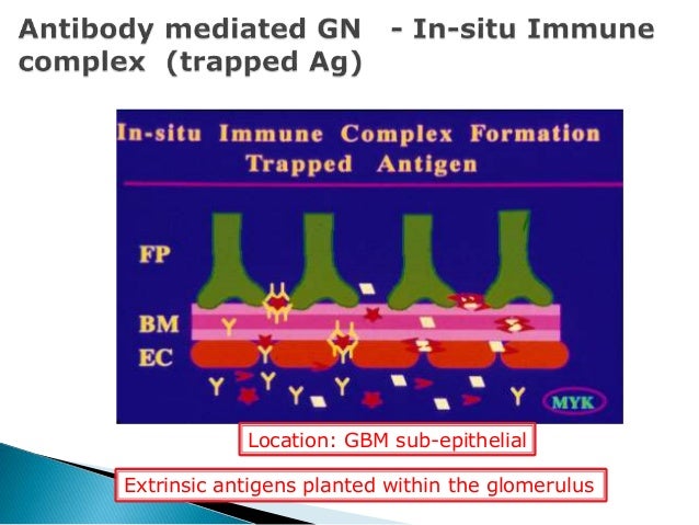 glomerular disease