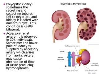 Polycystic kidney-
sometimes the
secreting and
collecting tubules
fail to negotiate and
kidney is riddled with
numerous cyst. This
condition is usally
bilateral.
 Accessory renal
artery- it is observed
in 30% individuals.
Sometimes the lower
pole of kidney is
supplied by accessory
artery which arises
from aorta. Artery
may cause
obstruction of flow
of urine producing
hydronephrosis.
 