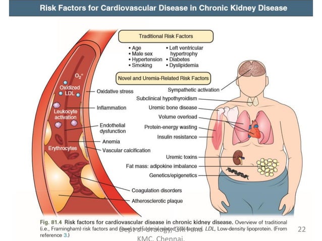 Chronic Kidney Disease | PDF