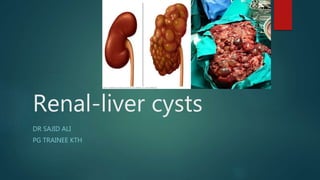 Renal-liver cysts
DR SAJID ALI
PG TRAINEE KTH
 