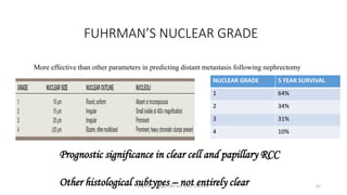 CLINICAL FEATURES & PROGNOSTIC FACTORS OF RCC | PDF