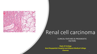 Renal cell carcinoma
CLINICAL FEATURES & PROGNOSTIC
FACTORS
Dept of Urology
Govt Royapettah Hospital and Kilpauk Medical College
Chennai
1
 