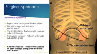 MANAGEMENT OF LOCALLY ADVANCED RENAL CELL CARCINOMA | PDF
