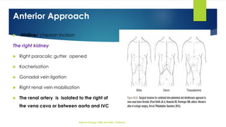 Chevron Invision MANAGEMENT OF LOCALLY ADVANCED RENAL CELL CARCINOMA | PDF