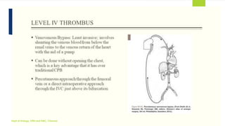 MANAGEMENT OF LOCALLY ADVANCED RENAL CELL CARCINOMA | PDF