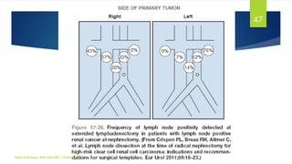 MANAGEMENT OF LOCALLY ADVANCED RENAL CELL CARCINOMA | PDF