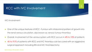 MANAGEMENT OF LOCALLY ADVANCED RENAL CELL CARCINOMA | PDF