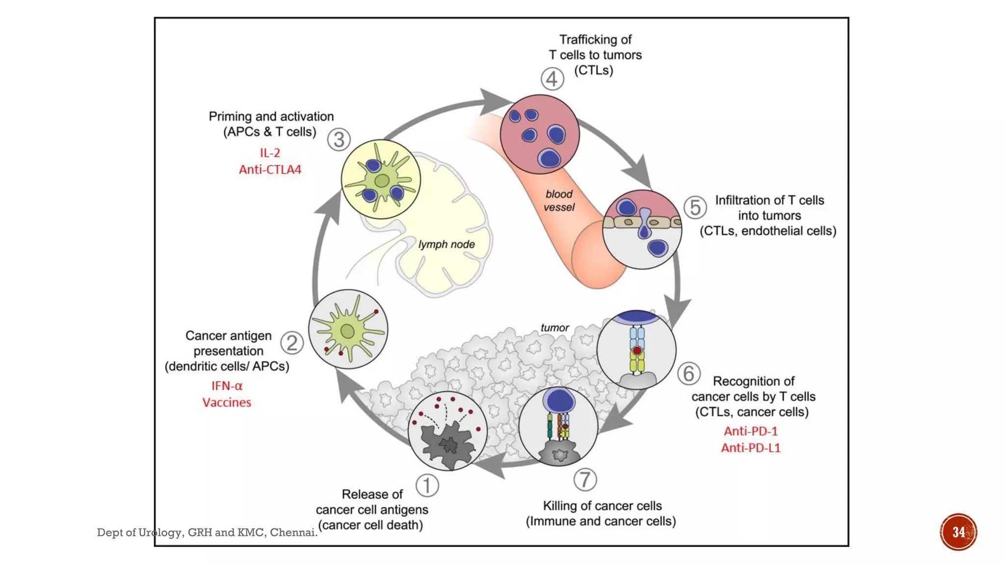 MANAGEMENT OF METASTASIS RENAL CELL CARCINOMA | PDF